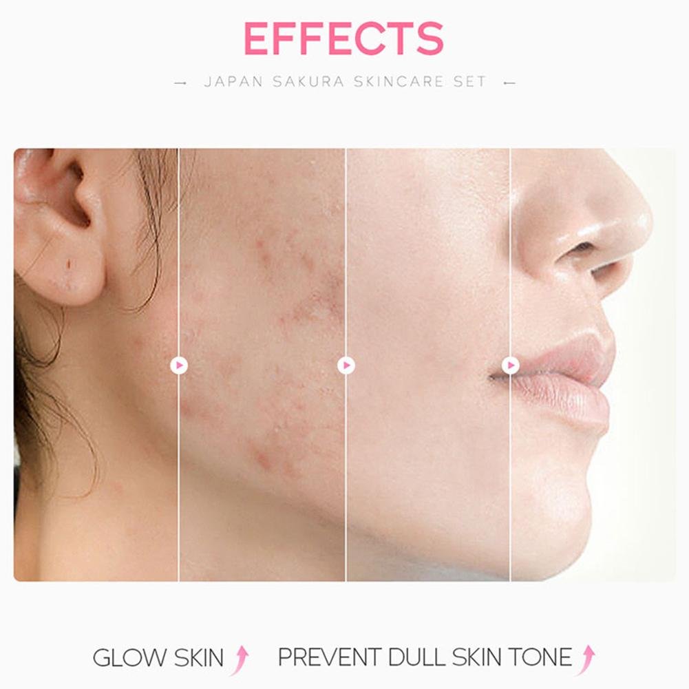 Japan Sakura Skincare Set – Facial Cleanser, Toner, Serum, Cream & Eye Cream (5 pcs) - CosmétiquebyLyria