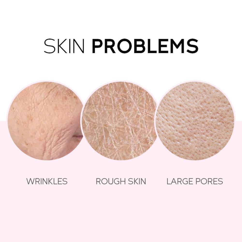 Japan Sakura Skincare Set – Facial Cleanser, Toner, Serum, Cream & Eye Cream (5 pcs) - CosmétiquebyLyria