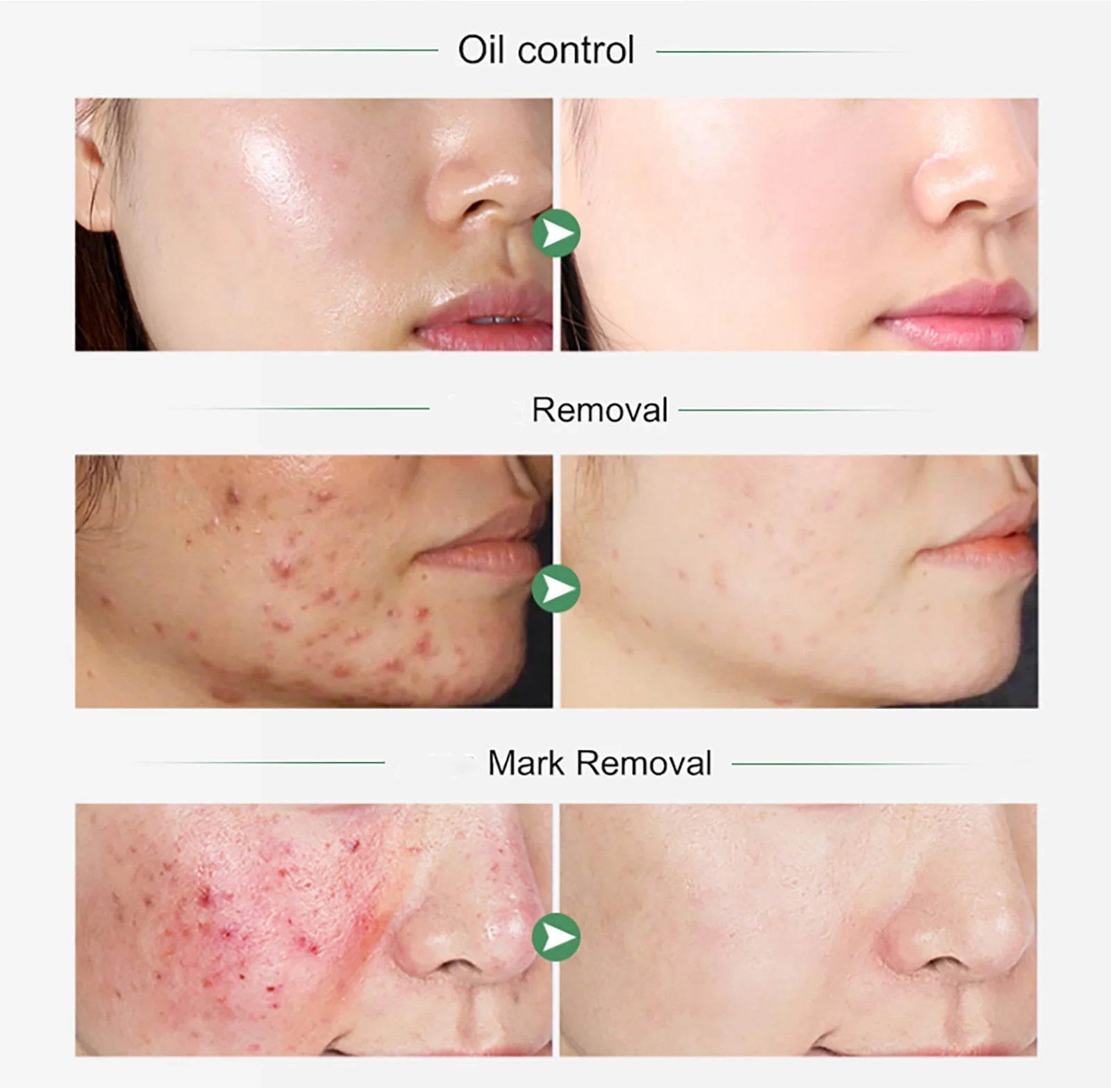 Turmeric & Vitamin C Skincare Set – Brightening, Hydrating & Acne Control. - CosmétiquebyLyria