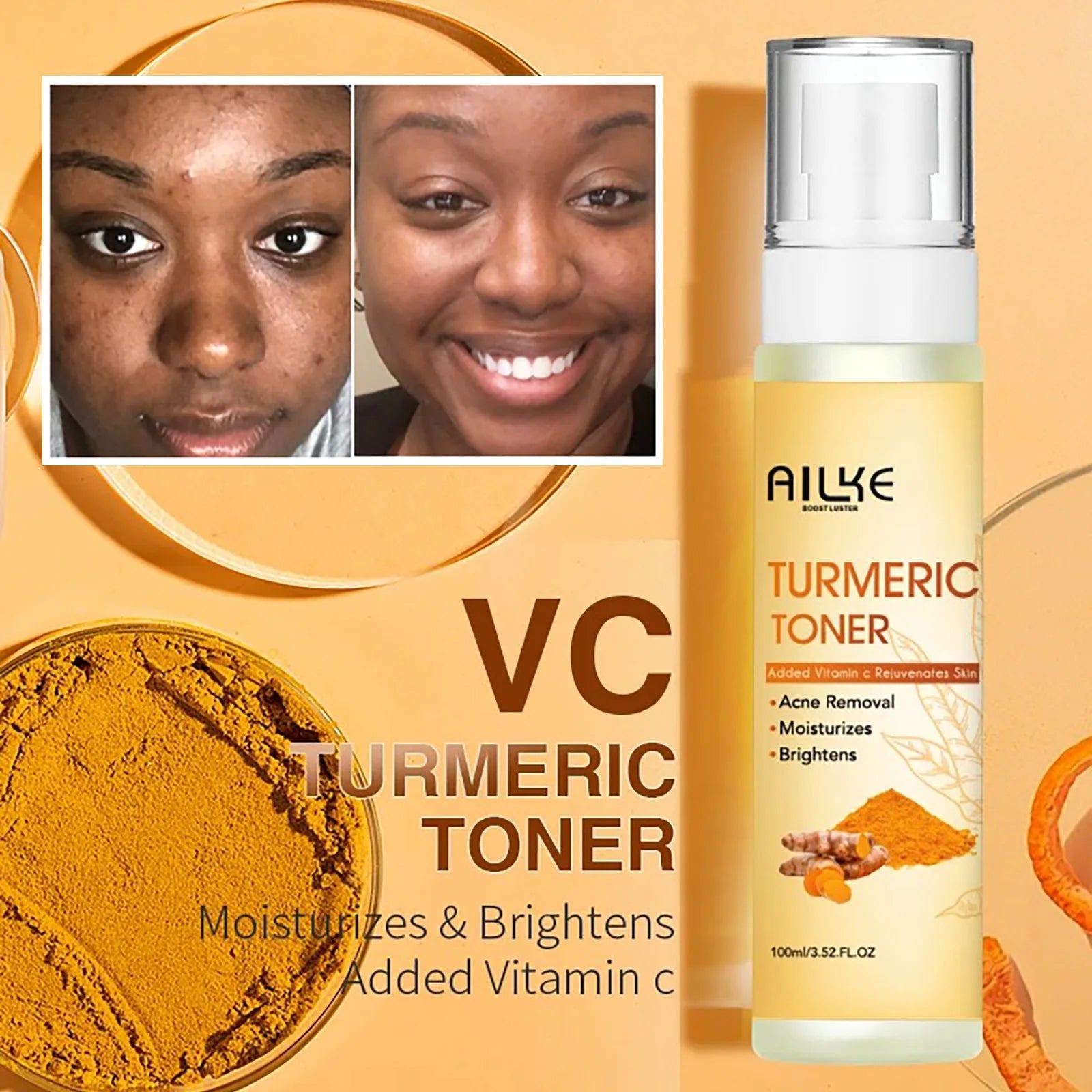 Turmeric & Vitamin C Skincare Set – Brightening, Hydrating & Acne Control. - CosmétiquebyLyria